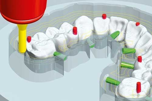 cadcam